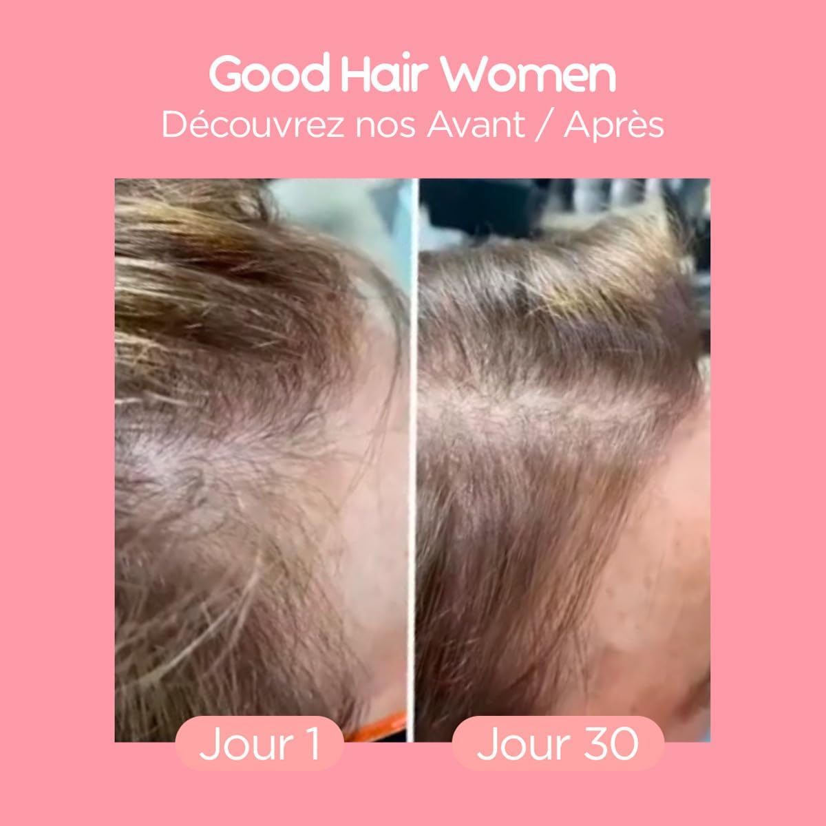 Lashilé Beauty - Good Hair Women - Anti-Chute de Cheveux -Compléments Alimentaires - Made in France - Cheveux de Venus, Biotine, Fer, Zinc, MSM, Vitamine B6, B12 - Cure 1 mois - 60 Gummies